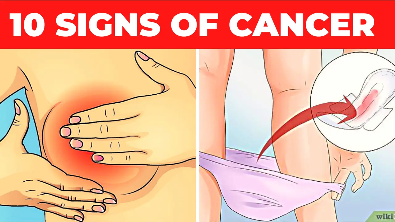 10 signs of cancer Early signs of cancer in women