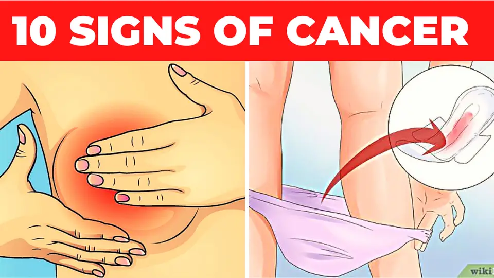 10 Signs of Cancer Mostly Ignored By Women