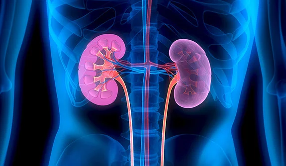 What is a Kidney Cleanse