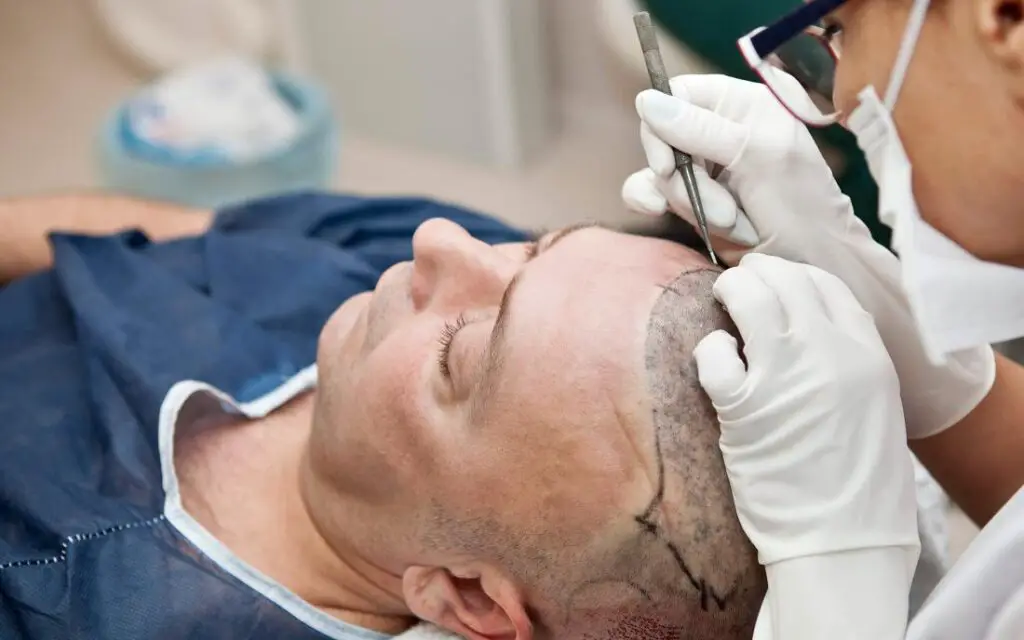 Hair Transplant Surgery